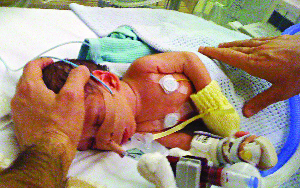 Jacob (above) and his sister Brooke were born six weeks premature