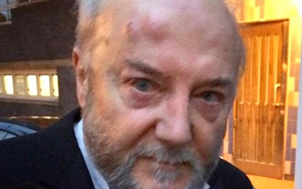 The anti-Israel politician suffered facial injuries following an assault in Golborne Road, Notting Hill, London.
