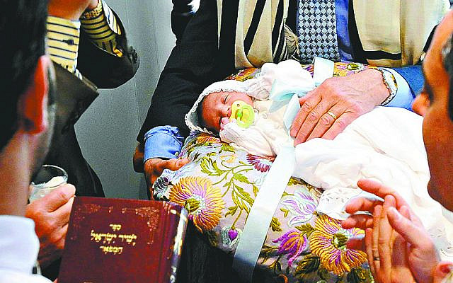 Circumcision is a fundamental belief in Orthodox Judaism