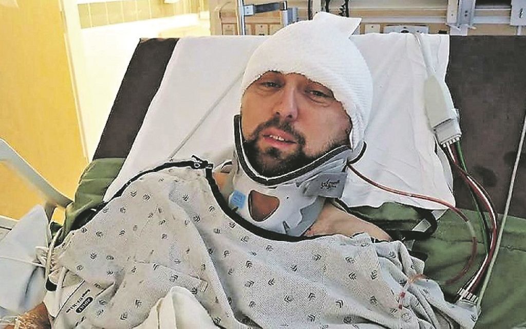 Marcus Freed has undergone a second round of brain surgery, following a hit-and-run accident on Friday night