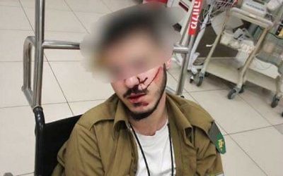 A Druze soldier attacked and beaten by other soldiers is seen at hospital (Facebook photo, family - via Times of Israel)