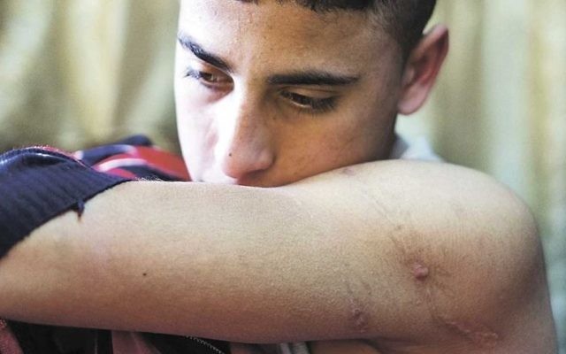Hamze Abu Hashem with the scar he claims he received. (Picture: Twitter)