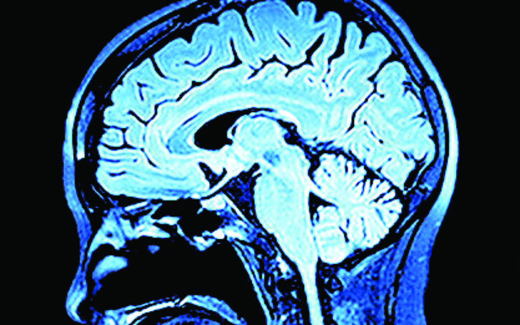 Imaging of the brain on mri scan