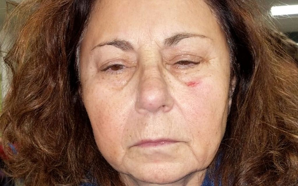 Sharon Klaff after allegedly being assaulted