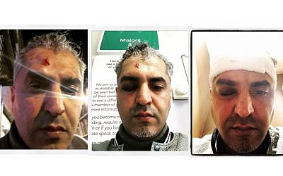 Split screen shows Maajid Nawaz after the racist attack, covered in bandages and blood