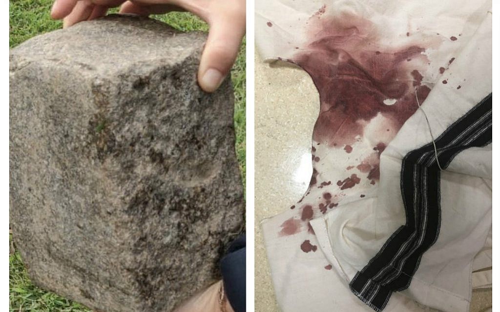 Image from @BennysMusic on Twitter, showing the brick thrown, and blood-stained tzitzit