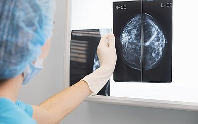 Pictured, a doctor or nurse holding a mammogram in front of x-ray illuminator. (Credit: Queen Mary University of London)