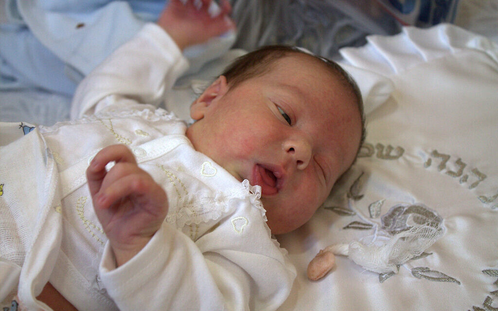 A Jewish couple in New Zealand couldn’t get a mohel to perform a bris for their son. Pictured is an unrelated stock image of a bris.