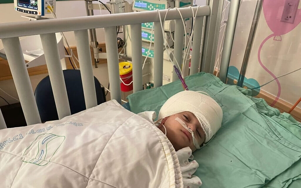 Soroka Medical Center handout photo of one of the conjoined twins after they were separated by British surgeon Dr Noor ul Owase Jeelani in a rare 12-hour surgery at the Soroka Medical Centre in Israel. Issue date: Monday September 6, 2021.