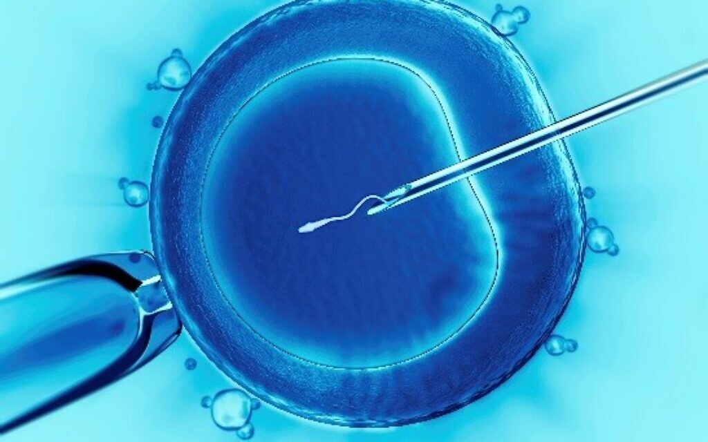 IVF Pic: Wikipedia