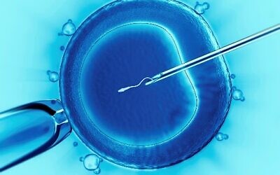 IVF Pic: Wikipedia