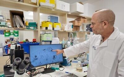 Prof. Benjamin Dekel points to kidney organoids grown in the lab at Sheba Medical Centre. Photo Credit: Sheba Medical Centre