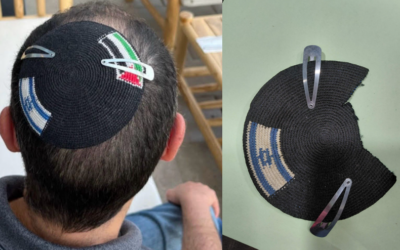 Alex Sinclair's kippah, before and after it was taken by the police