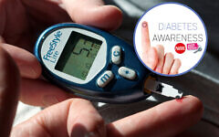 Diabetes mellitus, or simply diabetes, is a group of metabolic diseases in which a person has high blood sugar Diabetes mellitus, or simply diabetes, is a group of metabolic diseases in which a person has high blood sugar