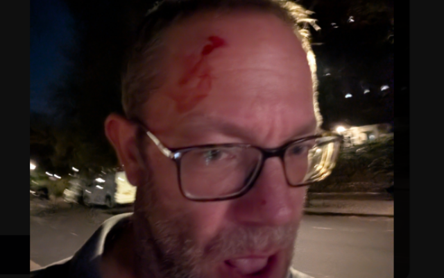 Dan Levene following incident with two men daubing anti-Labour candidate slogan